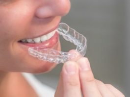 Aligners vs Braces- Know Which One is Ideal for You