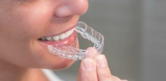 Aligners vs Braces- Know Which One is Ideal for You