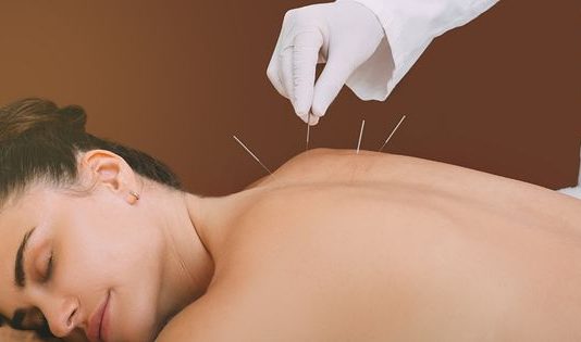 acupuncture Singapore
