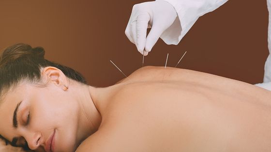 acupuncture Singapore