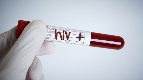 HIV Treatment! is HIV Becoming Curable