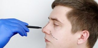 How to Choose the Right Rhinoplasty Surgeon to Perform Your Nose Surgery