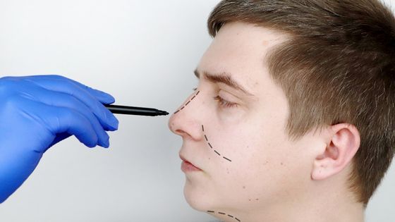 How to Choose the Right Rhinoplasty Surgeon to Perform Your Nose Surgery