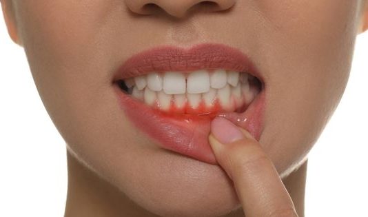 What Do You Need To Know About Abscessed Tooth